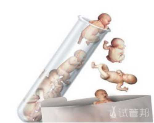 从广州去泰国，广州试管婴儿助孕机构选择攻略