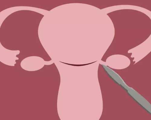 子宫切除后还怀孕_女孩子宫出血切除,8月统计：济源卵巢早衰患者可以做试管婴